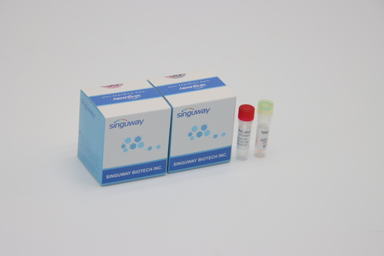 ชุดตรวจจับ PCR เรืองแสงเชิงปริมาณ IVD สำหรับการกลายพันธุ์ของไวรัส Corona ทั้งหมด