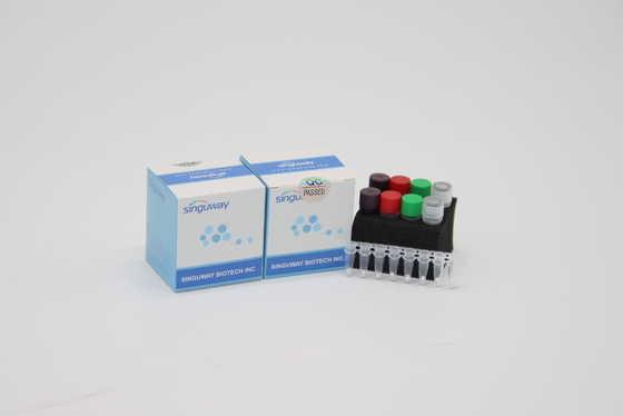 ชุด PCR แบบเรียลไทม์สำหรับ HIV ความแม่นยำสูง POCT IVD Clinical เรียลไทม์ PCR Diagnostic ชุดs