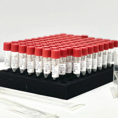 คอหอย Nasal Swab Sample Release Reagent Extraction Kit 0.5mL / Tube โดยไม่ต้องเตรียมการล่วงหน้า